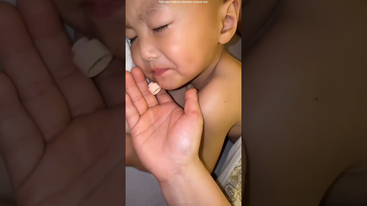 What was inside the sleeping boy mouth