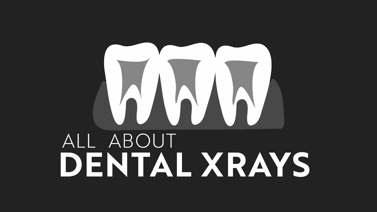 All About Dental X Rays