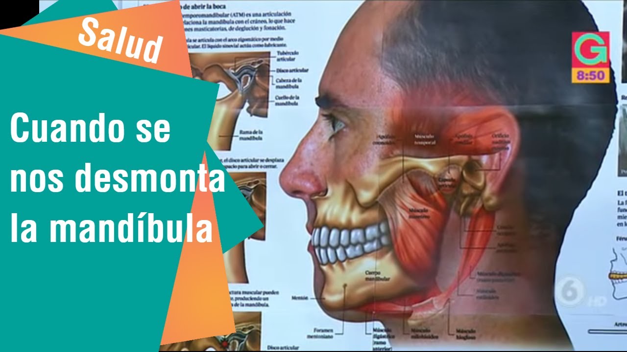 Mandibula travada?! Ig gess.soad #boca #mandibula #trismo #dentista #s