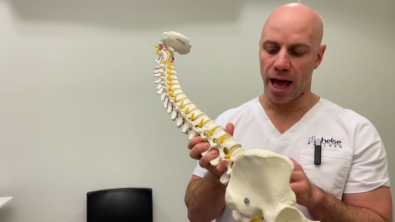 Prolaps og cauda equina syndrom