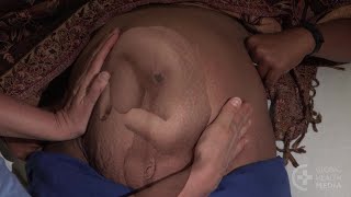 The Position of the Baby (Tamasheq) - Childbirth Series