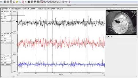 Standard EEG Recording Video Demo