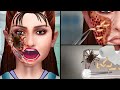 Asmr treatment animation  removal of maggot infected by spider  jinjja  asmr