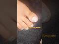 Do You Know Can Actually Slay Acrylic Nails On Your Toes? #tutorial #subscribe #nailart #nails
