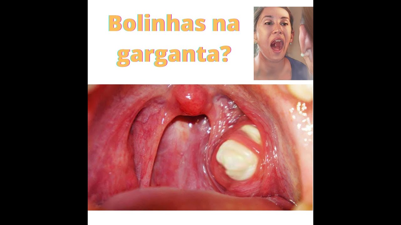 bolinhas