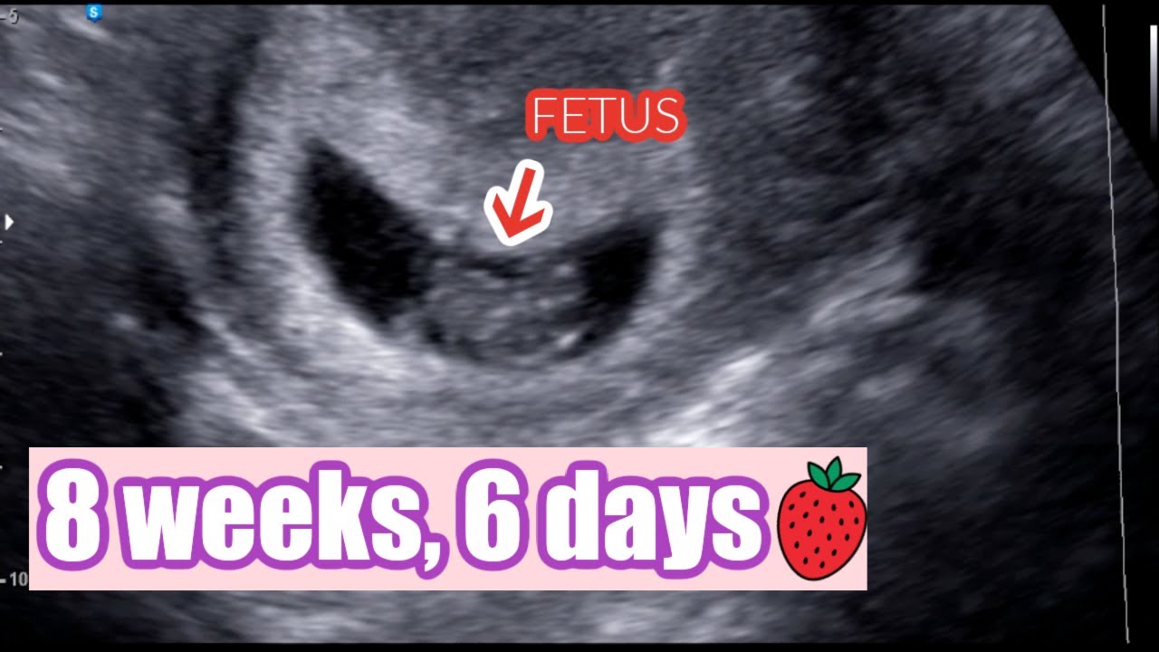 Beautiful Ultrasound Video of 8 Weeks + 6 Days | Pregnancy - YouTube