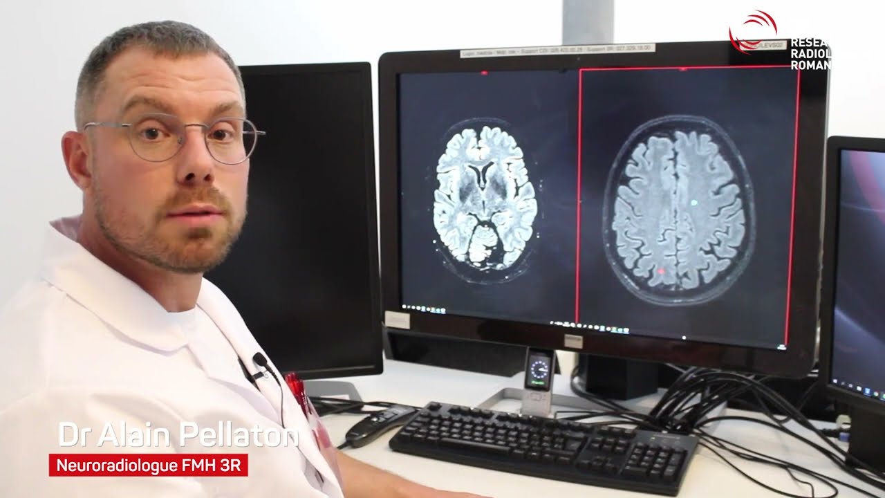 Pixyl.Neuro presentation by 3R - part 2: case study