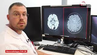Pixyl.Neuro presentation by 3R - part 2: case study