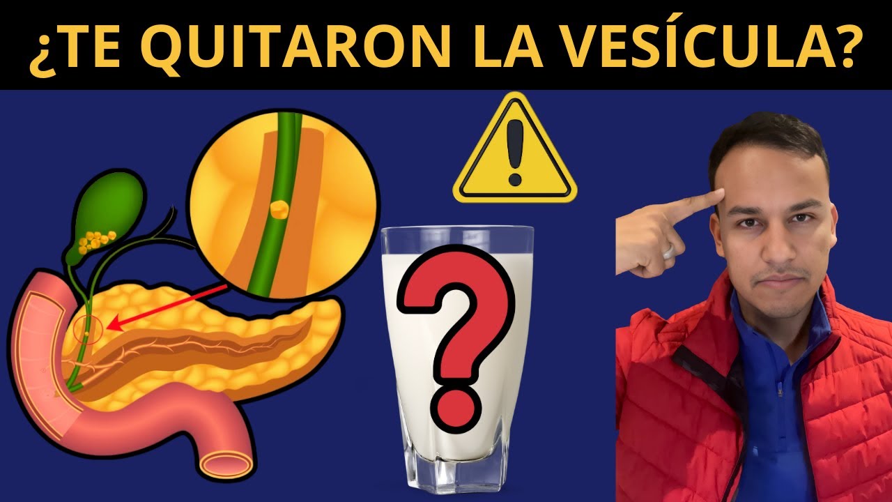 Dieta si te quitaron VESÍCULA - ¿Cómo comer postcolecistectomía?