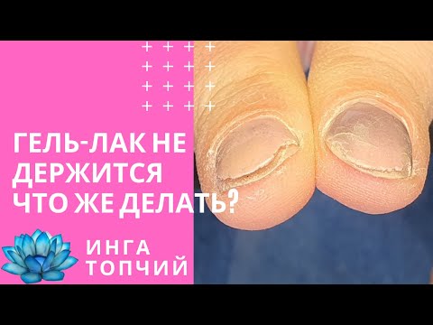 Гель лак на короткие ногти. Не держится. Что делать #13