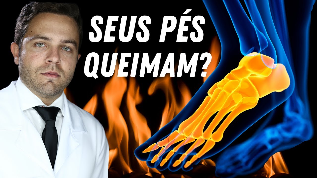 QUEIMAÇÃO NOS PÉS: 10 CAUSAS de FORMIGAMENTO e DOR nos PÉS | Dr. João ...