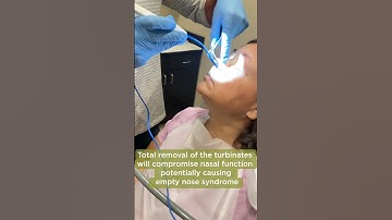 TURBINATE REDUCTION | Balloon Septoplasty [Part 2]