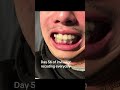 day56