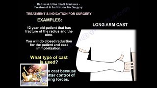 Radius/Ulnar Shaft Fx Treatment Indication Surgery-Everything You Need To Know-Dr. Nabil Ebraheim