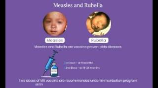 MR IEC Video - Case-Based Surveillance for Measles and Rubella