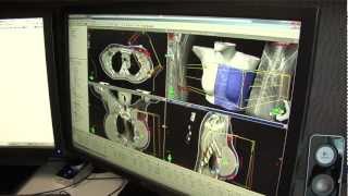 Highlands Oncology Group