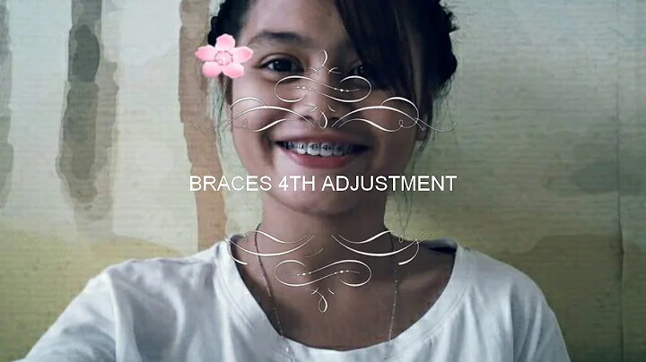 Braces 4th adjustment update| orthodontic braces| ...