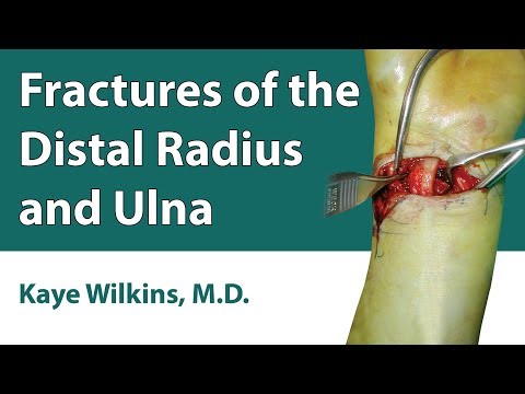 Fractures Of The Distal Radius & Ulna - YouTube