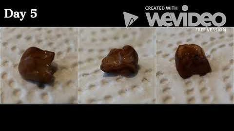 Tooth in Coca-Cola Experiment