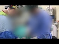 Chirurgie d'injection de graisse au pénis
