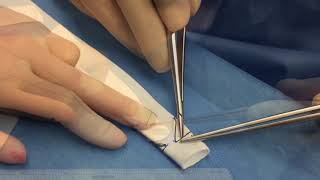 Bileaflet Polytetrafluoroethylene Conduits for Right Ventricular Outflow Tract Reconstruction