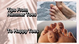 How to Promote Healing Hammer Toes | Acupressure & Exercises