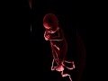 How I deliver babies -Real life Labour Room experience of a Doctor. #mbbs #doctor #motivation