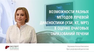 Возможности разных методов лучевой диагностики (УЗИ, КТ, МРТ) в оценке очаговых образований печени.