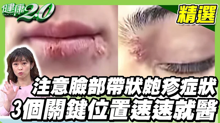 注意臉部帶狀皰疹症狀！ 臉上長皮蛇要注意 長在這3個關鍵位置速速就醫【健康2.0精選】 - 天天要聞