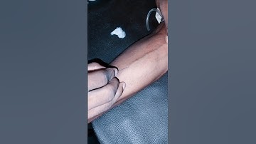 i.v #injection #Intravenous #youtubeshorts #hospital #trending #viralvideo ......