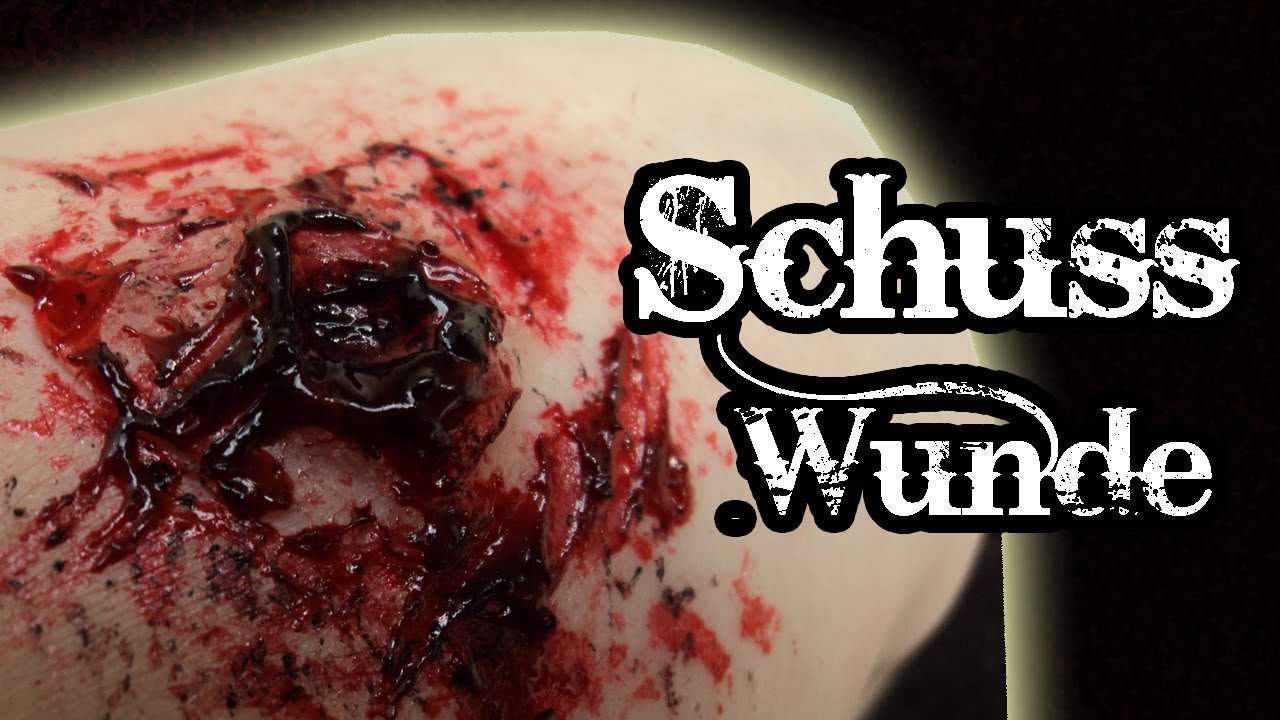 schusswunde schusswunde