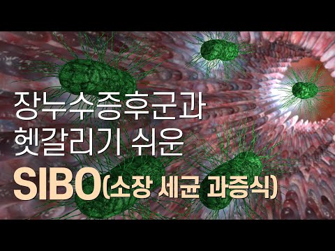 소장세균과증식(SIBO)의 증상, 원인, 진단, 치료