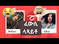 ፈውሲ ላጻይቶ How To Get Rid Of Alopecia