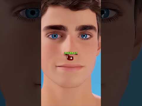 Que Faire Quand Son Nez Coule Du Sang