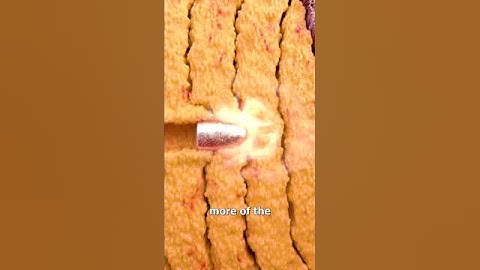 Saved By Belly Fat 😮