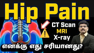 “Back Pain Diagnosis: Which Test Is Needed for X Ray, CT Scan, or MRI Scan?”