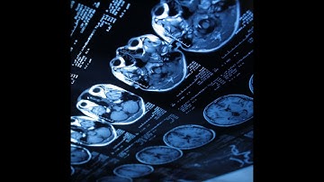 Brain Tumor Segmentation using UNET Tensorflow | Machine Learning| +91-8283824812 for query