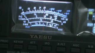 A61BK A61AB DX