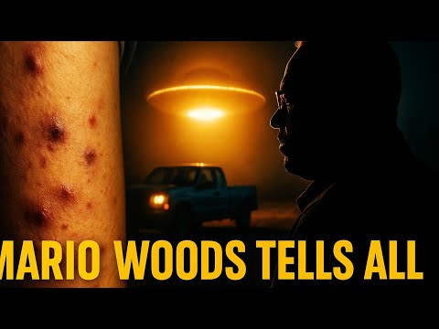 Unexplained Pockmarks & Burns – The Aftermath of a UFO Encounter with Mario Woods.