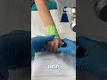 Vein Scanners - The Latest Innovation in Medicine
