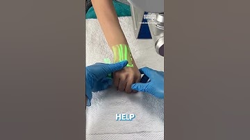 Vein Scanners - The Latest Innovation in Medicine