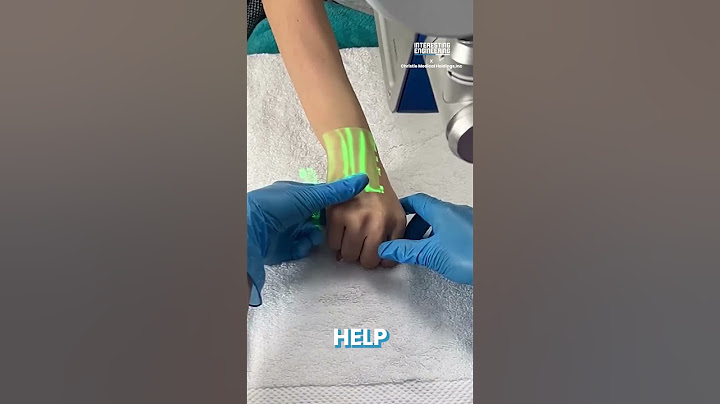 Vein Scanners - The Latest Innovation in Medicine