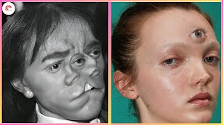 20 World Records Even Doctors Can't Explain | Then and Now 2025