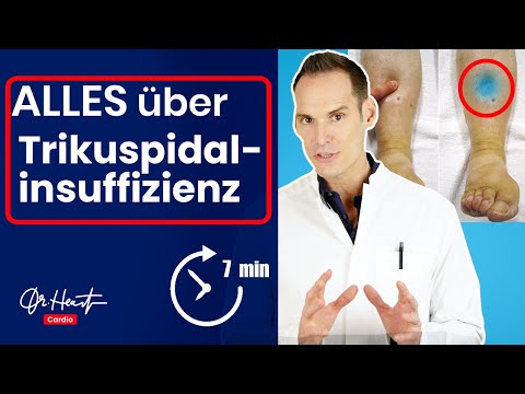 Video: Kann Trikuspidalinsuffizienz Müdigkeit verursachen?