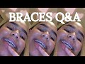 BRACES Q&amp;A | Tawana