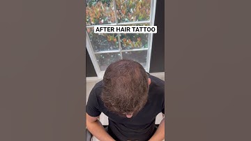 ADDING DENSITY TO THINNING HAIR 🙏🏼 #scalpmicropigmentation #smp #smptraining