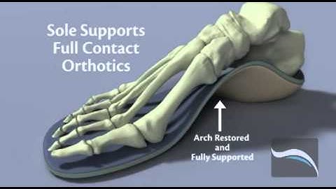 Sole Supports and Your Pregnancy