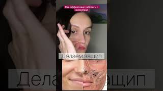 Как быстро убрать носогубку #shorts #носогубка