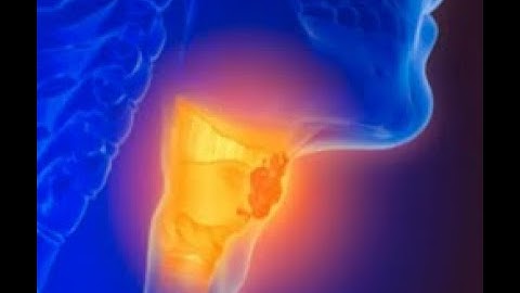 हाइपोथायरॉयड SYMPTOMS INVESTIGATIONS AND TREATMENT #THYROID #thyroidhealth #thyroidproblems