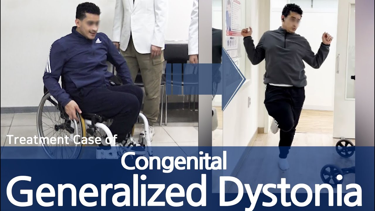Congenital Generalized Dystonia / Leg jerks / walking disorder / speech disorder /poor grip strength